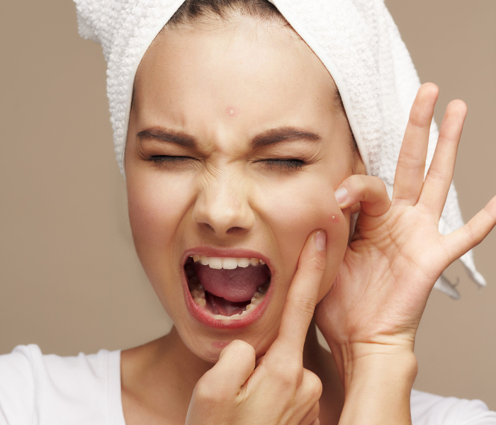 Why pimples take their sweet time to heal - how to speed up recovery for clear, glowing skin!