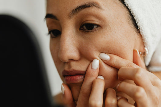 Why pimples take their sweet time to heal - how to speed up recovery for clear, glowing skin!