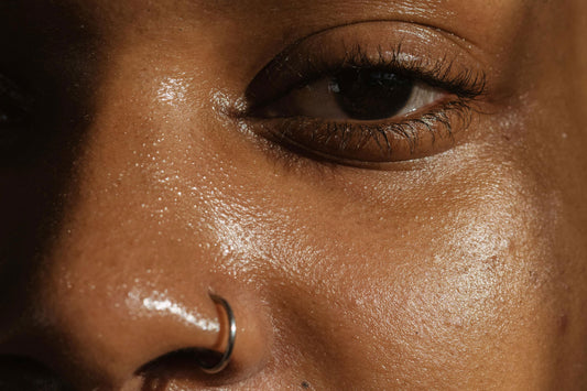 Do you actually have Oily Skin? Here's the Top 4 signs (with a surprising caveat!)