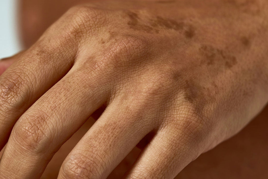 How antioxidants protect your skin from free radical ageing