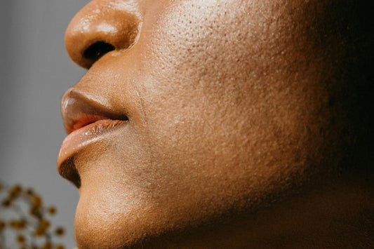 The one step breakout-prone skin is missing: deep pore detox