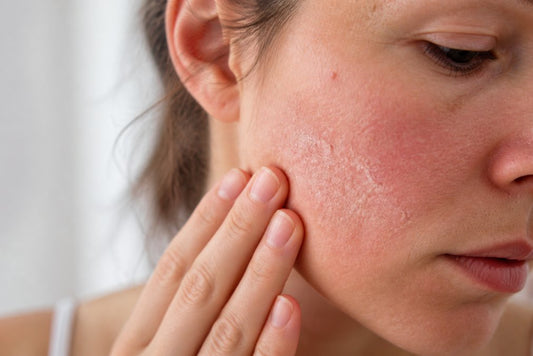 How to Repair a Damaged Skin Barrier