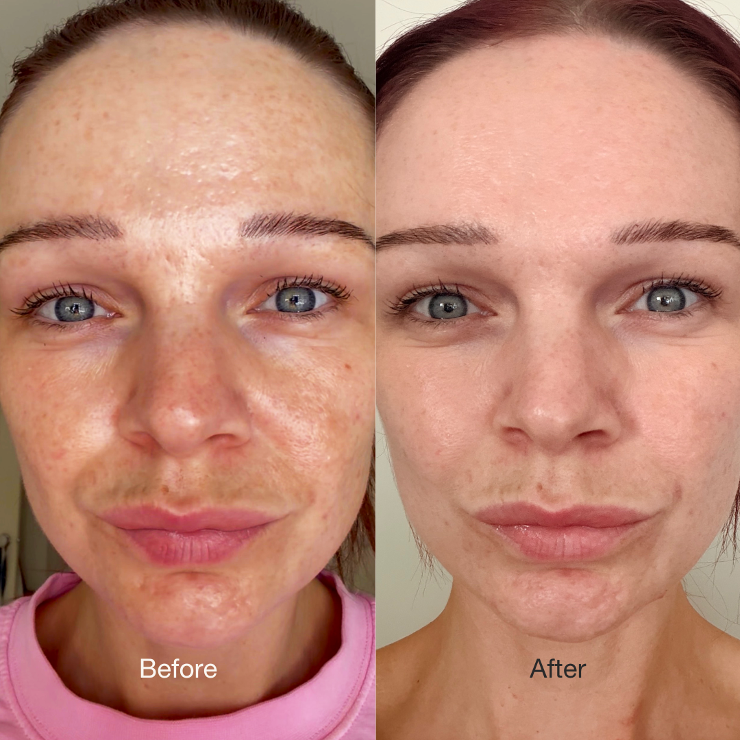 Perfect Skin Prep Kit